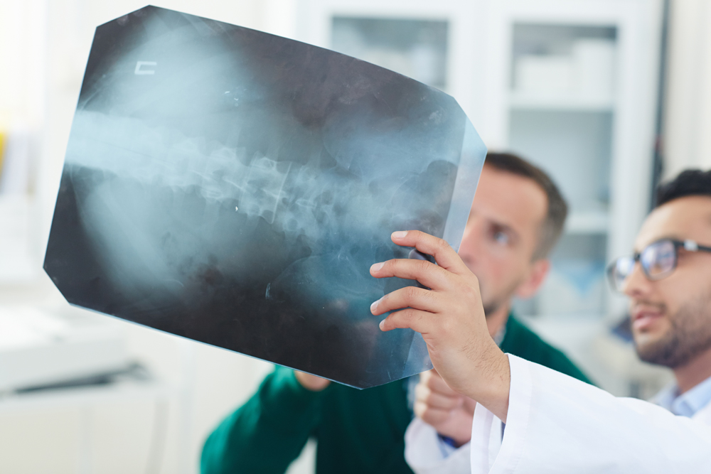 spinal-x-ray